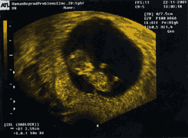 Фотография эмбриона